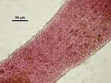 4 - Cellule corticali in visione superficiale